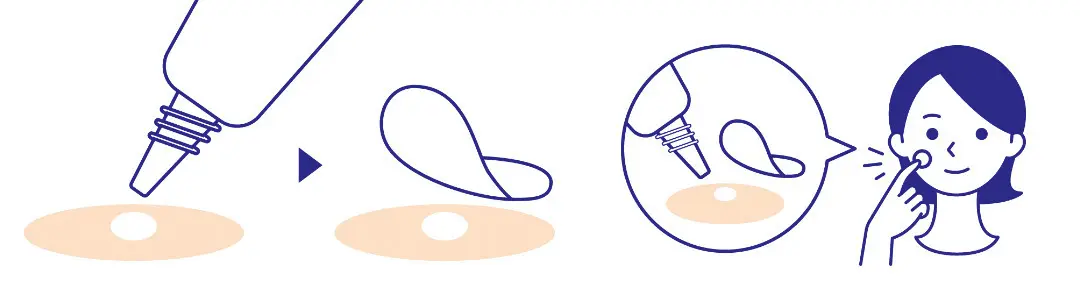 【ニキビケア】「アクネスラボ」のスポッツの画像_3