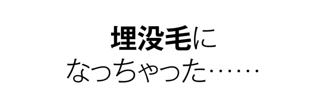 ムダ毛のお悩みQ&Aの画像_1