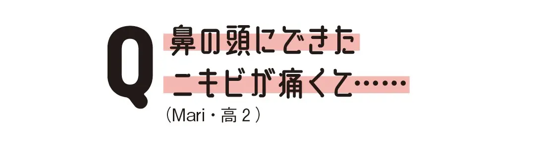 正しくケア！ニキビお悩みQ＆Aの画像_1