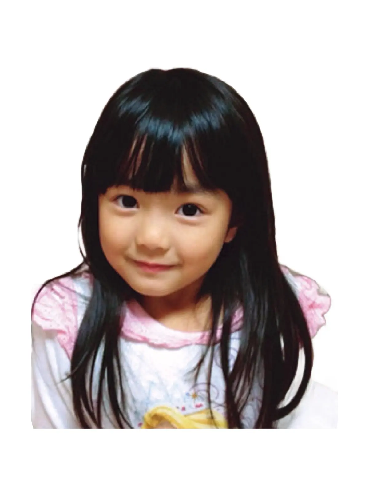 ４歳。やんちゃで傷が絶えなかったw